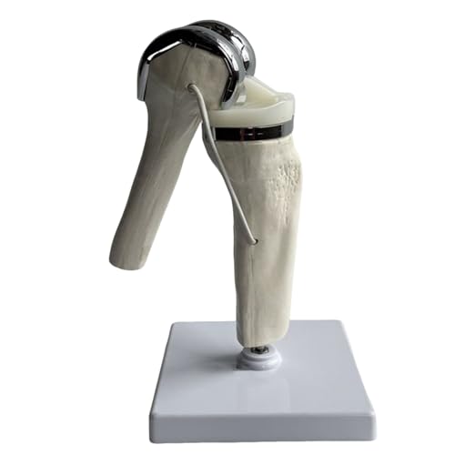 Outil d'enseignement anatomique du genou pour expliquer l'arthroplastie aux patients