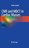  CMR and MDCT in Cardiac Masses (English Edition)