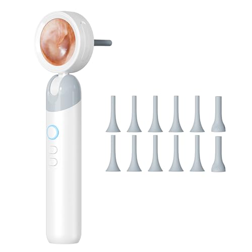 Ear Camera with 1.21” Screen, 1080P HD Digital Otoscope Ear Scope with 4 LED Lights, Skin Inspection Probe, 10 Ear & Nose Tips, 6 Ear Pick Tools, for Adults Kids Pets, Type-C Charging (White)