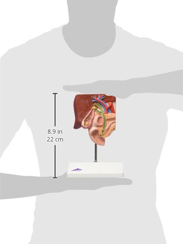 Person holding the 3B Scientific K26 Gallstone Model to show its scale