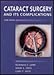 Cataract Surgery And Its Complications