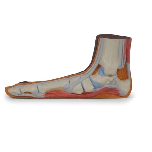 3B Scientific Fußmodell Plattfuß (Pes planus), dunkle Hautfarbe - 3B Smart Anatomy