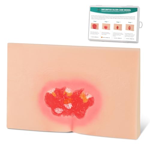 Image of Decubitus Ulcer Wound Care Model, Bedsores Model
