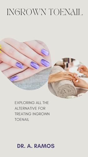INGROWN TOENAIL: EXPLORING ALL THE ALTERNATIVE FOR TREATING INGROWN TOENAIL