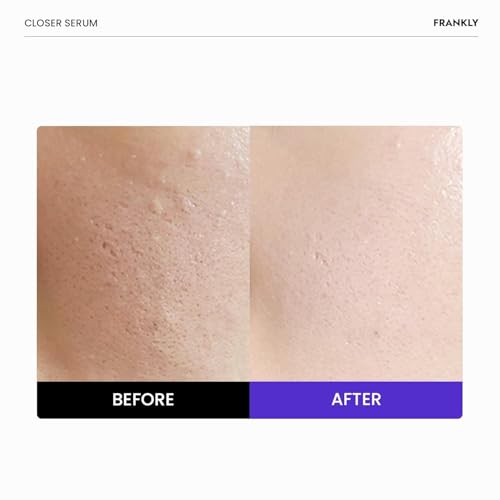FRANKLY Closer Serum | Pore Minimizer Serum | 9 Peptides, Vegan Collagen, Adenosine, PHA | Korean Pore Minimizer for Glass Skin, Anti-Aging, Hydration, Elasticity | 1.01 fl oz - Image 3