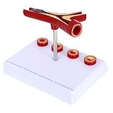 Adorainbow Cardiovascular Anatomical Model with Thrombus Hardening Display Teaching Medical Model for Doctors