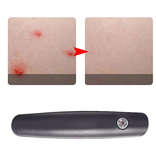 Anti-jeuk apparaat, mug jeukwerende eenvoudig en prachtig apparaat jeukwerende pen voor kinderen en volwassen… - Image 3