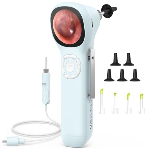 ScopeAround Digital Otoscope w/IPS Screen 720p HD Smart Video Otoscope with Light Ear Scope Otoscope with Camera Ear Wax Removal Camera Ear Checker Power On and Go (Blue)