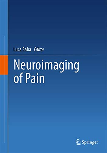 Buy Neuroimaging of Pain — BookShops.in