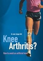 Knee Arthritis? How to Avoid an Artificial Knee 3000065202 Book Cover