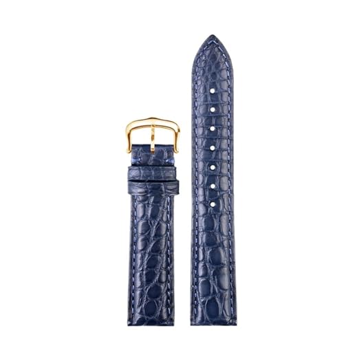 [-ł] JeBG YfB[X U[EHb`Xgbv L[}Xg h \ NR_CEHb`oh 16 18 19mm uXbgΉ(Blue-gold,16mm)