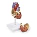 Walter Products B10405A Human Heart Model, Life Size, 2 Parts, 4.5 x 3 x 3 Inches