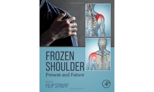 Frozen Shoulder: Present and Future view 2