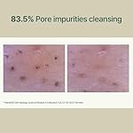 Pyunkang Yul PKY Calming Low pH Foaming Cleanser | Daily Face Wash & Makeup Remover with Tea Tree, Centella Asiatica, 5 Hyaluronic Acids that Removes Dead Skin Cells, Hydrates Skin - 150ml 5.07 Fl.Oz. - Image 5