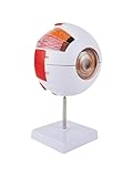 6X Enlarged Eyeball Model Detachable Eye Anatomy Model with Stand for Medical Science Education & Classroom...