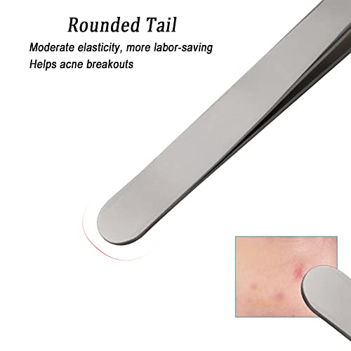 Professional Facial Blackhead Remover Tweezers,3Pcs Precision Pimple Popper Tool Kit For Whitehead Ance Blemishs Comedones Stainless Steel Makeup Tool - Matte #TOP5