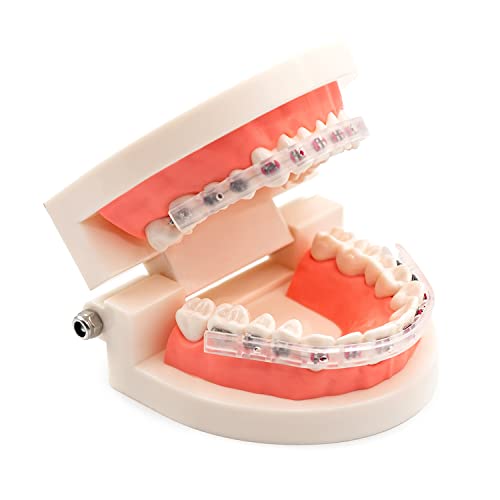 Aim Lip Protector for Braces, Comfort Covers for Braces, Orthodontic Mouth Guard for Braces, Wax Braces Cover, Lip Bumper, Lip Shield for Brackets, Braces Accessories (Lip Protector) - Thumbnail 3