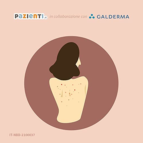 Acne del tronco: prevenirla e curarla