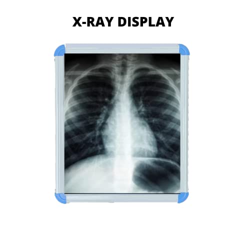 Image of Dr. Care X-Ray View Box Single Flm With Automatic Film Activation and Variable Brightness Control(Size-14X17 Inch) /led display White