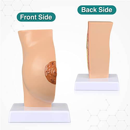 Image of Ultrassist Non-Lactating Breast Model, Human Anatomy Model, Breast Anatomical Model with Study Card for Doctor Surgeon Gift