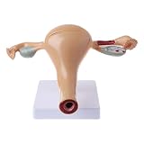 MIKI-Z Utérus Pathologique Humain Modèle Ovaire Anatomie Anatomique Pathologie Maladie Lésion Médicale pour l'enseignement