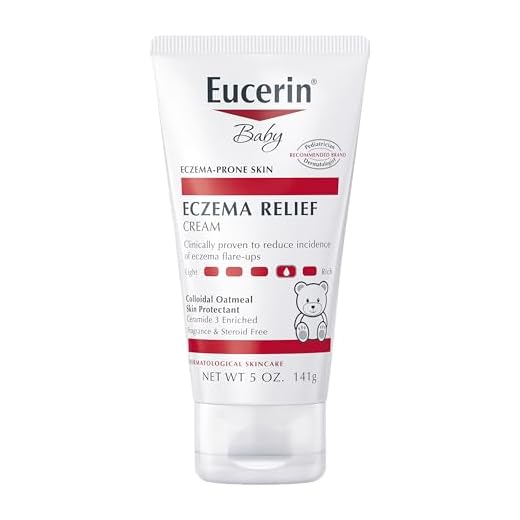 Eucerin Baby Eczema Relief Body Cream - Steroid & Fragrance Free for 3+ Months of Age - 5 oz. Tube