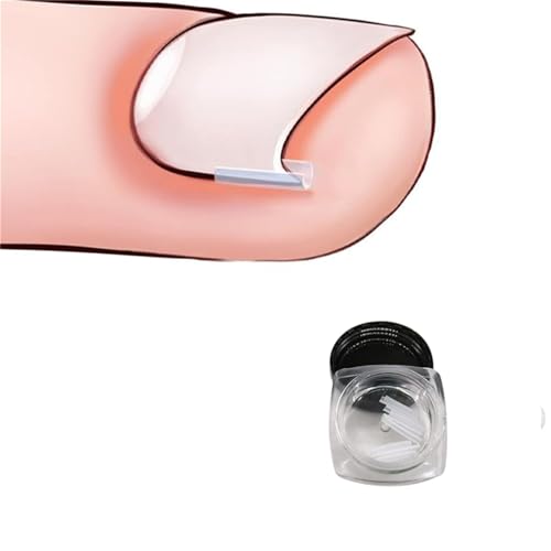 10 Pcs Ingrown Toenail Correction Strips Brace Kit, Ingrown Toenail Corrector Straightener Strips Recover Toenails Thick Pedicure Tool, Toenail Straightener Strip, Ingrown Toenail Tools, Nail Tools