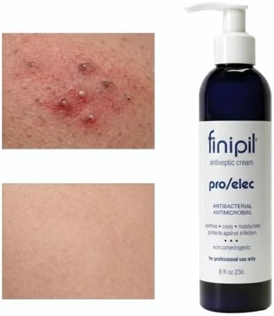 Nufree finipil Pro After Hair Removal Ingrown Hair Treatment Cream, 8 Oz