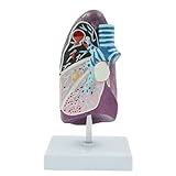 Pathologisches Lungenmodell des Menschen, abnehmbar, zeigt Raucherlunge, Abszess, Tuberkulose, Lungenentzündung und Krebs Modelle & Schulungsmaterialien