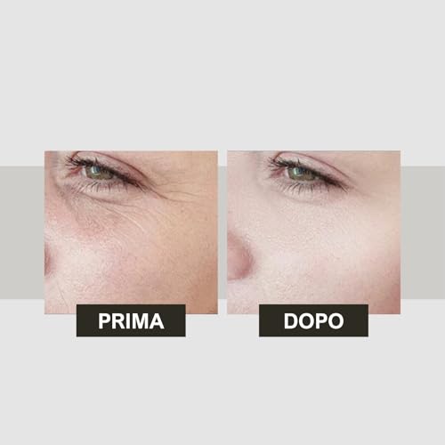 Mineralium - Siero Anti-Rughe Alla Vitamina C Per Tutti I Tipi Di Pelle - Potente Anti-Età, Riduce Le Rughe - Arricchito Con Minerali Del Mar Morto E Aloe Vera - Senza Siliconi Né Parabeni - 30Ml - 6