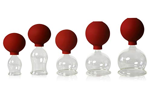 Lauschaer Glas 5er Schröpfglas-Set mit Ball 30-40-50-60-70mm zum professionellen, medizinischen,feuerlosen Schröpfen mundgeblasen, handgeformt, Schröpfglas, Schröpfgläser, Origina