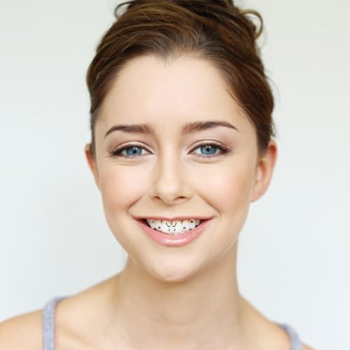 2 Schachteln Schmetterlings-Zahnbohrer, Diy-Zahnkristallschmuck, Zahndekorationsbedarf, Kosmetische Zahnärztliche Werkzeuge (Transparent + Farbe).