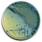 CBC Anaerobe Blood Agar (20 per Pack)