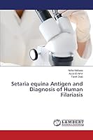 Setaria equina Antigen and Diagnosis of Human Filariasis 3659802735 Book Cover