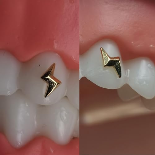 Image of CHAMON Tooth Gems, 8K Solid Gold Lightning Shape Aesthetic Smile Decoration | 8K Gold, Lead-free, Curvature conforms to tooth surface