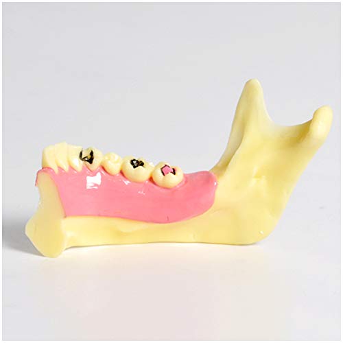 Modelo de descomposición del tejido mandibular para estudio dental pedagógico 4