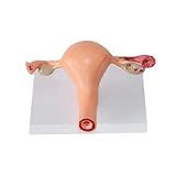 Huhpa