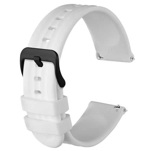 [Anbeer] 20mm voh VR rvxg Quick Release ւoh jp p O XeXX`[obN