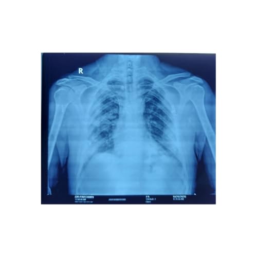 『TEST of PODCAST 10001』のカバーアート