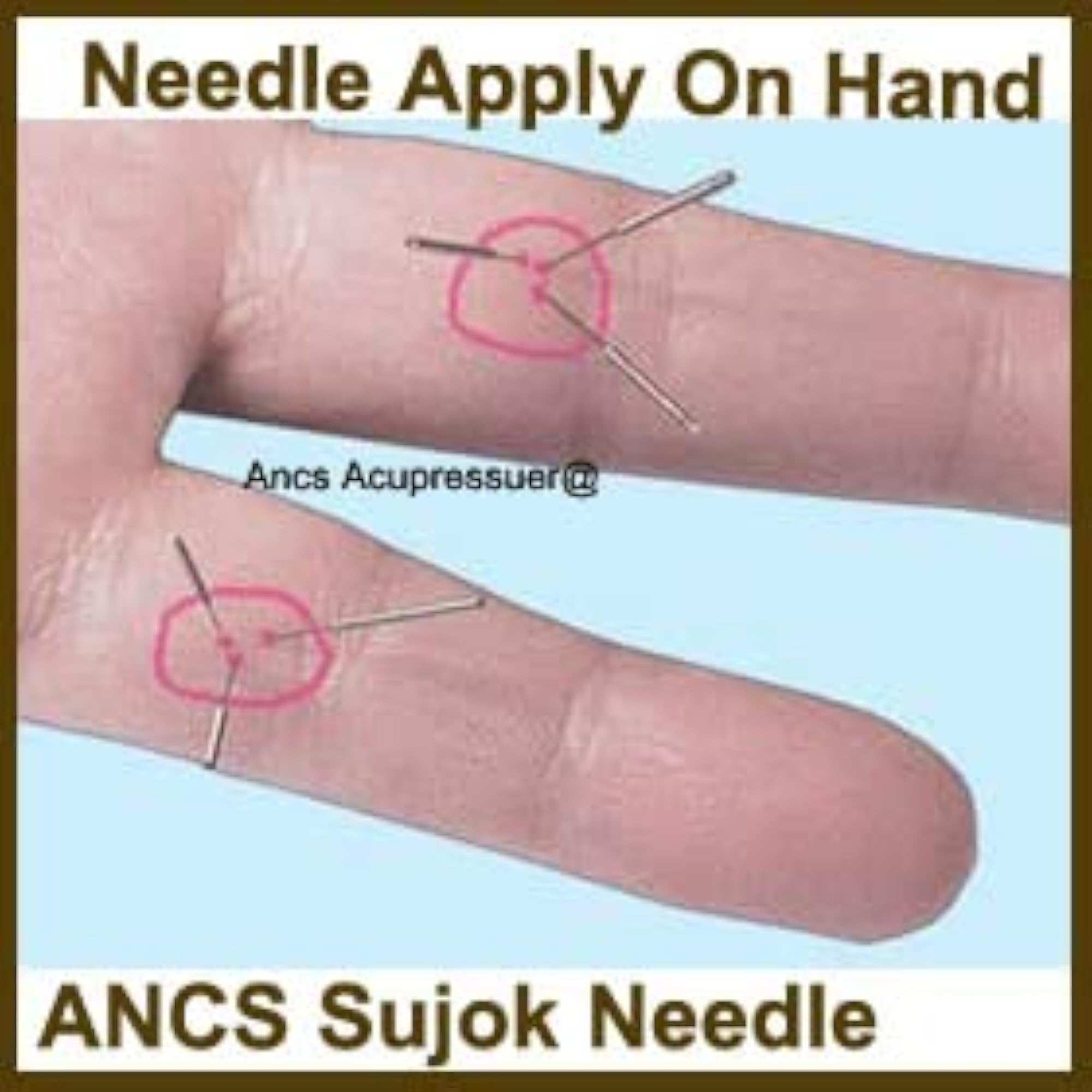 ANCS Sujok Acupressure Needle Set, 50pc