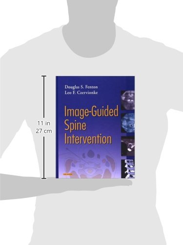 Image-Guided Spine Intervention