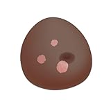 3B Scientific SONOtrain Ultraschall‑Brustmodell mit Tumoren P125D – dunkle Hautfarbe