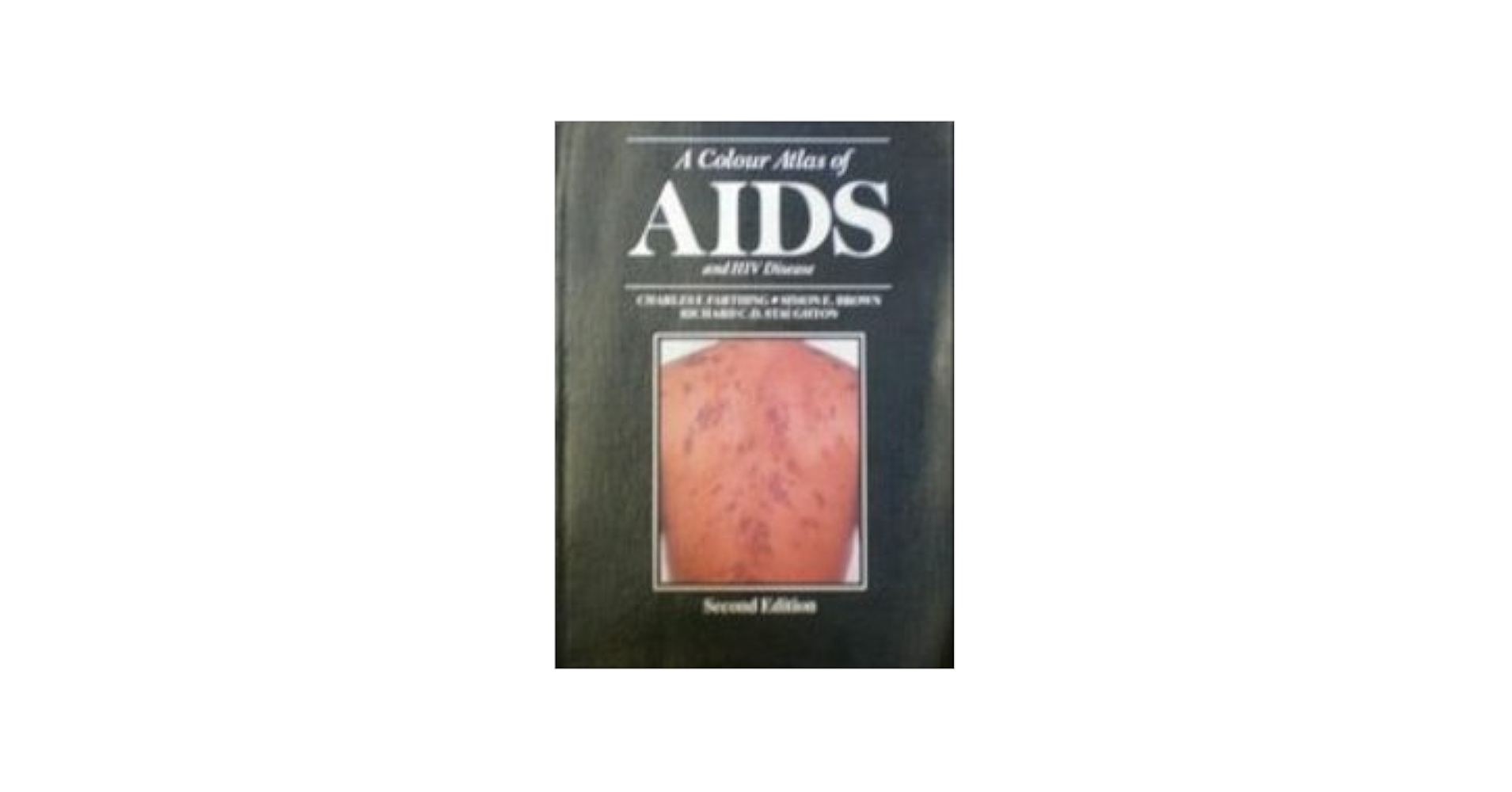 カラ-アトラスＡＩＤＳ   /医学書院/チャ-ルズ・Ｆ．ファ-シング（単行本） カラ-アトラスAIDS /医学書院/チャ-ルズ・F．ファ-シング