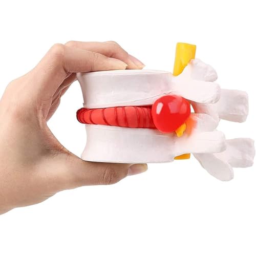 Human Lumbar Disc Herniation Demonstration Model of Lumbar Vertebral Spine