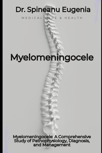 Myelomeningocele: A Comprehensive Study of Pathophysiology, Diagnosis, and Management