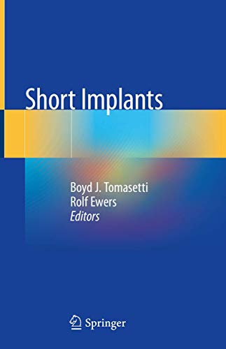 Short Implants view 2