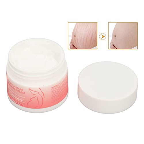 Creme para Remoção de Cicatrizes, Creme para Remoção de Estrias para Mulheres, Creme Reparador Nutri