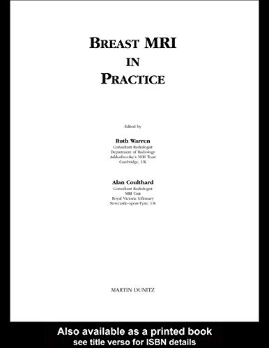 Breast MRI in Practice view 2