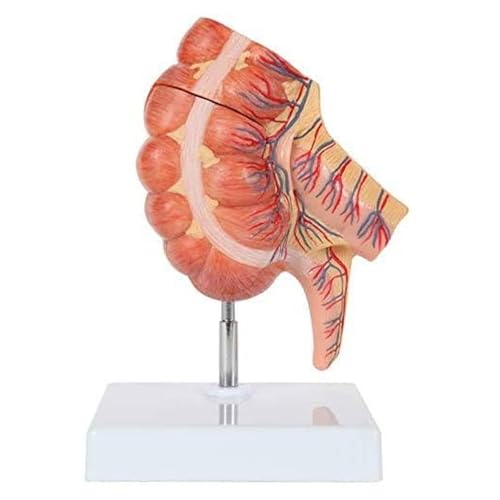 Modelo anatómico del ciego y el apéndice humano, agrandado 1,5 veces. detallado intestino grueso con válvula ileocecal