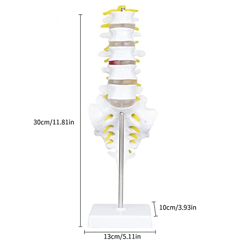 Image of Life Size Lumbar Vertebrae Sacrum Coccyx & Nerves Anatomical Spinal Column for Chiropractor, Medical Students, Teaching & Demonstration